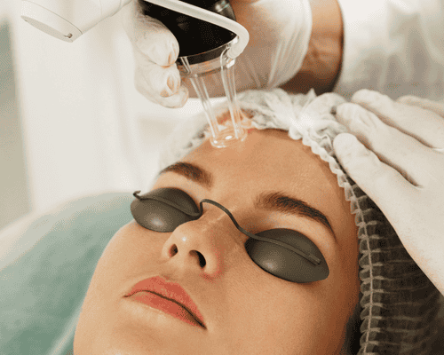 Laser Skin Treatments
